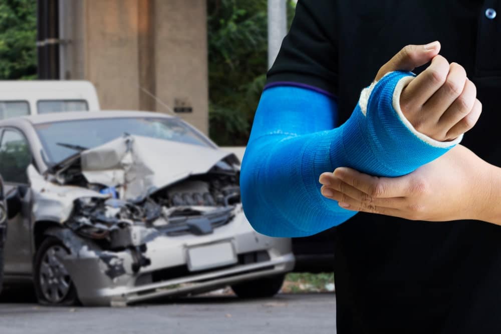 San Diego Broken Bone Injury Lawyer: Your Ultimate Guide From The Traffic Accident Law Center